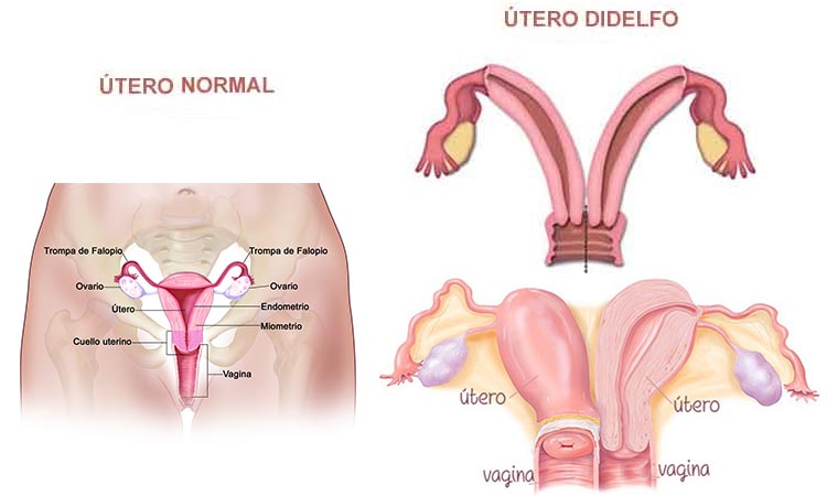 UteroDidelfo1