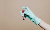 Semana Europeia do Teste VIH-Hepatites: Faz o teste e ajuda a travar novos casos